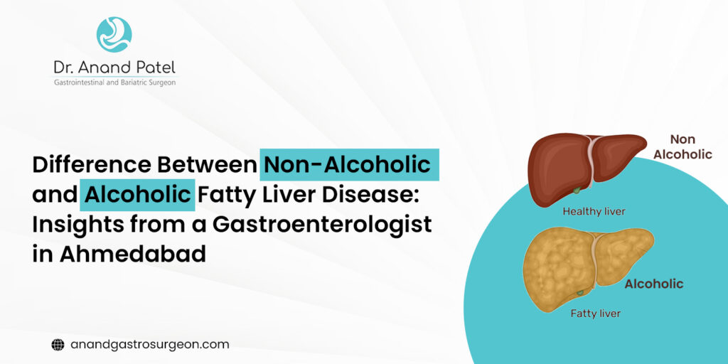 Non-Alcoholic and Alcoholic Fatty Liver Disease : Gastroenterologist in Ahmedabad